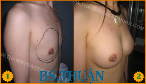 Nang-nguc-bang-tui-don-7