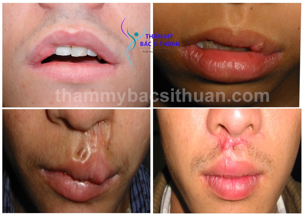 hinh-anh-xoa-seo-moi-1