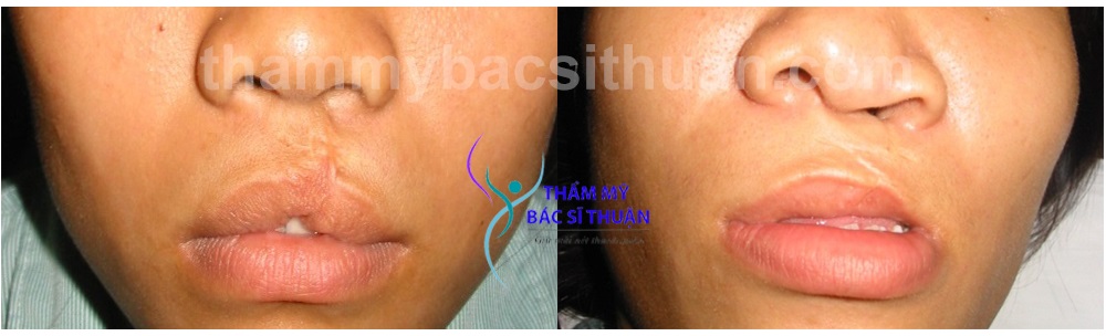 hinh-anh-xoa-seo-moi-2