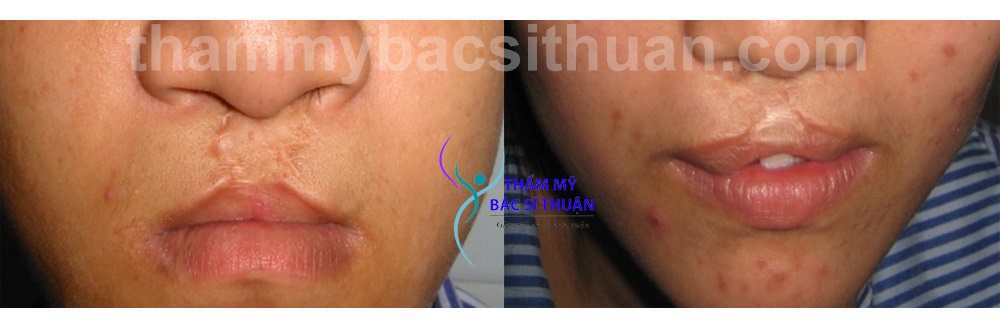 hinh-anh-xoa-seo-moi-3