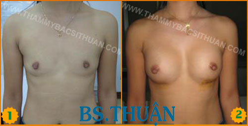 nang nguc bang tui don