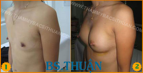 nang nguc bang tui don