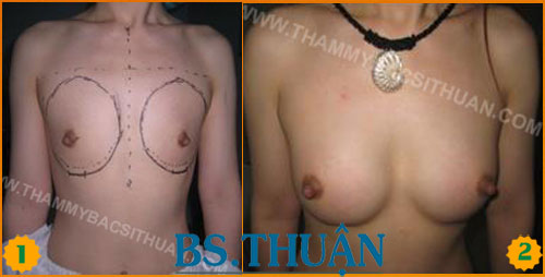 nang nguc bang tui don