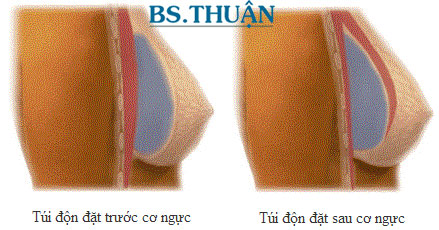 nang nguc bang tui don