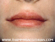 đôi môi mỏng