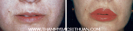 đôi môi mỏng